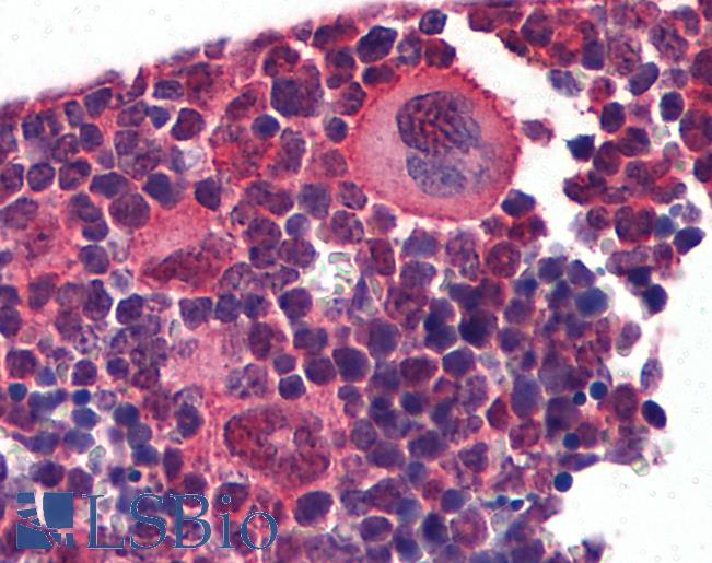 NKX2-3 Antibody - Anti-NKX2-3 antibody IHC of mouse lymphoid tissue. Immunohistochemistry of formalin-fixed, paraffin-embedded tissue after heat-induced antigen retrieval. Antibody concentration 5 ug/ml.  This image was taken for the unconjugated form of this product. Other forms have not been tested.