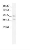 NKX2-3 Antibody - Fetal Spleen Lysate.  This image was taken for the unconjugated form of this product. Other forms have not been tested.
