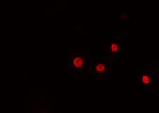 NKX2-4 Antibody - Staining HeLa cells by IF/ICC. The samples were fixed with PFA and permeabilized in 0.1% Triton X-100, then blocked in 10% serum for 45 min at 25°C. The primary antibody was diluted at 1:200 and incubated with the sample for 1 hour at 37°C. An Alexa Fluor 594 conjugated goat anti-rabbit IgG (H+L) antibody, diluted at 1/600, was used as secondary antibody.