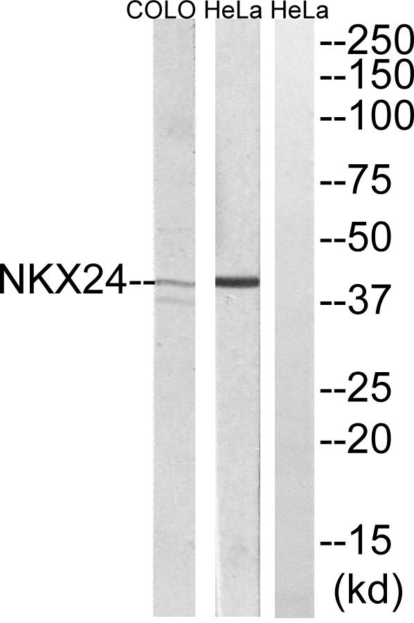 NKX2-4 Antibody - Western blot analysis of extracts from HeLa and COLO205 cells, using NKX24 antibody.
