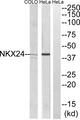 NKX2-4 Antibody - Western blot analysis of extracts from HeLa and COLO205 cells, using NKX24 antibody.