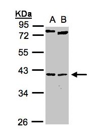 NKX2-5 Antibody - Sample (30 ug whole cell lysate). A: H1299, B: Raji . 10% SDS PAGE. NKX2-5 antibody diluted at 1:1000