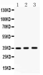 NKX2-5 Antibody - NKX2 antibody Western blot. All lanes: Anti NKX2 at 0.5 ug/ml. Lane 1: Mouse Spleen Tissue Lysate at 50 ug. Lane 2: Mouse Cardiac Muscle Tissue Lysate at 50 ug. Lane 3: HELA Whole Cell Lysate at 40 ug. Predicted band size: 35 kD. Observed band size: 35 kD.