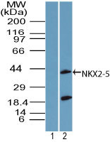 NKX2-5 Antibody - Western blot of NKX2-5 in human heart lysate using 1) pre bleed and 2) Polyclonal Antibody to NKX2-5 at 1 ug/ml.
