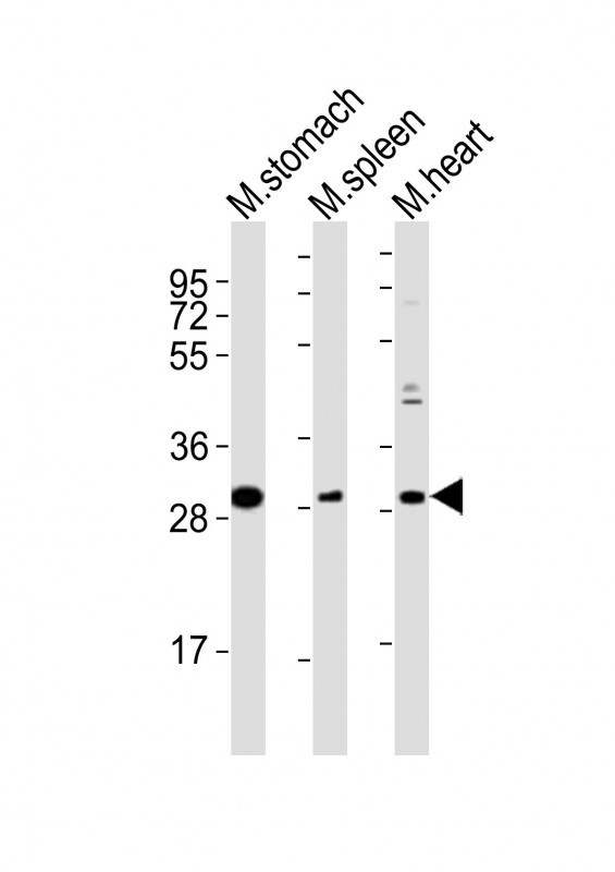 NKX2-5 Antibody - All lanes : Anti-Nkx2-5 Antibody at 1:2000 dilution Lane 1: mouse stomach lysates Lane 2: mouse spleen lysates Lane 3: mouse heart lysates Lysates/proteins at 20 ug per lane. Secondary Goat Anti-Rabbit IgG, (H+L), Peroxidase conjugated at 1/10000 dilution Predicted band size : 34 kDa Blocking/Dilution buffer: 5% NFDM/TBST.