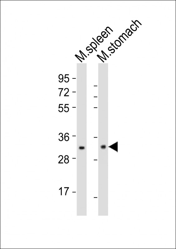 NKX2-5 Antibody - All lanes : Anti-Nkx2-5 Antibody at 1:1000 dilution Lane 1: mouse spleen lysates Lane 2: mouse stomach lysates Lysates/proteins at 20 ug per lane. Secondary Goat Anti-Rabbit IgG, (H+L), Peroxidase conjugated at 1/10000 dilution Predicted band size : 34 kDa Blocking/Dilution buffer: 5% NFDM/TBST.