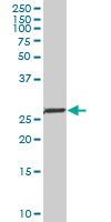 NKX2-5 Antibody - NKX2-5 monoclonal antibody (M01), clone 1E4-G5. Western Blot analysis of NKX2-5 expression in human thyroid(diffuse hyperplasia).