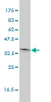 NKX2-5 Antibody - NKX2-5 monoclonal antibody (M01), clone 1E4-G5 Western Blot analysis of NKX2-5 expression in HeLa.