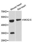 NKX2-5 Antibody - Western blot analysis of extracts of various cell lines, using NKX2-5 antibody at 1:3000 dilution. The secondary antibody used was an HRP Goat Anti-Rabbit IgG (H+L) at 1:10000 dilution. Lysates were loaded 25ug per lane and 3% nonfat dry milk in TBST was used for blocking. An ECL Kit was used for detection and the exposure time was 90s.