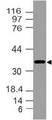 NKX2-5 Antibody - Fig-1: Expression analysis of NKX2-5. Anti-NKX2-5 antibody was used at 2 µg/ml on MCF-7 lysate.