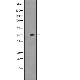 NKX2-5 Antibody - Western blot analysis of NKX2-5 expression in A431 whole cells lysate. The lane on the left is treated with the antigen-specific peptide.