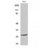 NKX2-6 Antibody - Western blot of Nkx-2.6 antibody