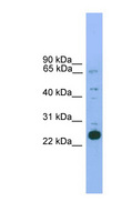 NKX2-6 Antibody - NKX2-6 antibody Western blot of Mouse Heart lysate. This image was taken for the unconjugated form of this product. Other forms have not been tested.