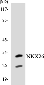 NKX2-6 Antibody - Western blot analysis of the lysates from Jurkat cells using NKX26 antibody.