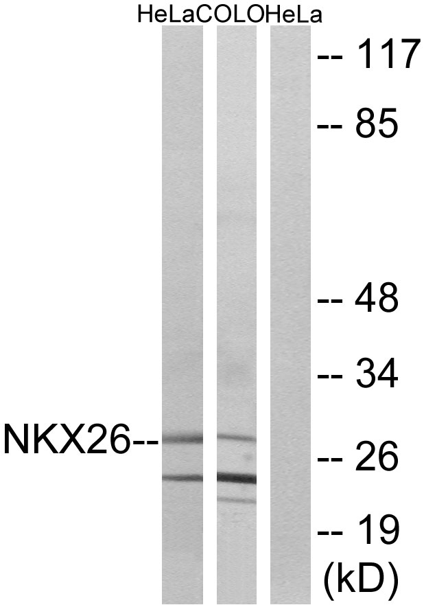 NKX2-6 Antibody - Western blot analysis of lysates from HeLa and COLO cells, using NKX26 Antibody. The lane on the right is blocked with the synthesized peptide.