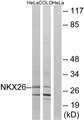 NKX2-6 Antibody - Western blot analysis of lysates from HeLa and COLO cells, using NKX26 Antibody. The lane on the right is blocked with the synthesized peptide.