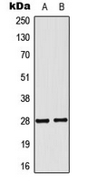 NKX2-6 Antibody - Western blot analysis of NKX2-6 expression in MCF7 (A); COLO205 (B) whole cell lysates.