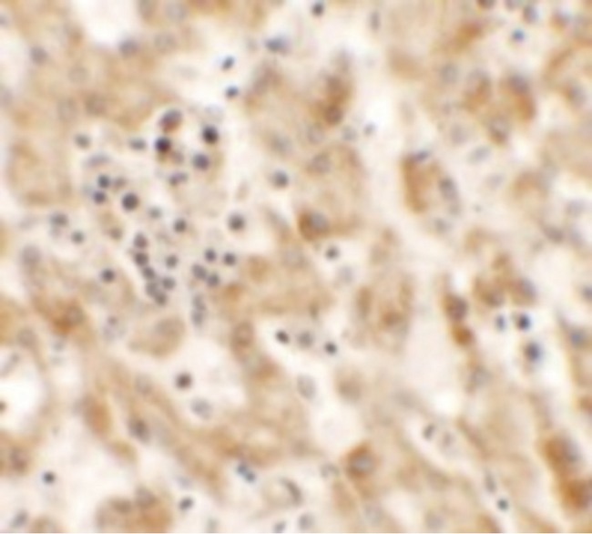 NKX2-6 Antibody - Immunohistochemistry of NKX2-8 in human liver tissue with NKX2-8 antibody at 2.5 ug/ml.