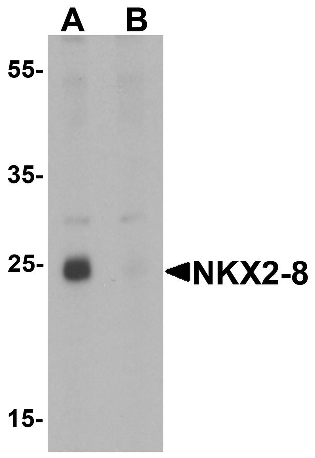 NKX2-6 Antibody - Western blot analysis of NKX2-8 in rat liver tissue lysate with NKX2-8 antibody at 1 ug/ml in (A) the absence and (B) the presence of blocking peptide