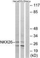 NKX2-6 Antibody - Western blot analysis of extracts from HeLa cells and COLO cells, using NKX26 antibody.