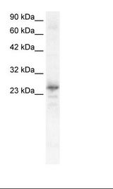 NKX2-8 Antibody - Fetal Heart Lysate.  This image was taken for the unconjugated form of this product. Other forms have not been tested.