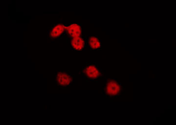 NKX2-8 Antibody - Staining HeLa cells by IF/ICC. The samples were fixed with PFA and permeabilized in 0.1% Triton X-100, then blocked in 10% serum for 45 min at 25°C. The primary antibody was diluted at 1:200 and incubated with the sample for 1 hour at 37°C. An Alexa Fluor 594 conjugated goat anti-rabbit IgG (H+L) Ab, diluted at 1/600, was used as the secondary antibody.