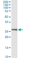 NKX3-1 Antibody - NKX3-1 monoclonal antibody (M01), clone 3H6. Western Blot analysis of NKX3-1 expression in human colon.