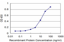 NKX3-1 Antibody - Detection limit for recombinant GST tagged NKX3-1 is approximately 1 ng/ml as a capture antibody.