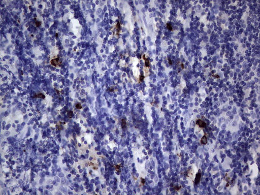 NKX3-1 Antibody - Immunohistochemical staining of paraffin-embedded Human tonsil within the normal limits using anti-NKX3-1 mouse monoclonal antibody. (Heat-induced epitope retrieval by 1 mM EDTA in 10mM Tris, pH8.5, 120C for 3min,