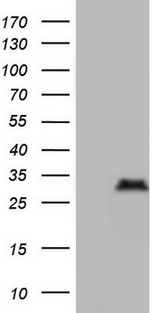 NKX3-1 Antibody - HEK293T cells were transfected with the pCMV6-ENTRY control (Left lane) or pCMV6-ENTRY NKX3-1 (Right lane) cDNA for 48 hrs and lysed. Equivalent amounts of cell lysates (5 ug per lane) were separated by SDS-PAGE and immunoblotted with anti-NKX3-1.