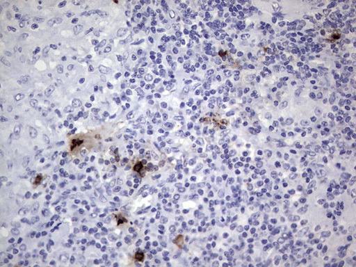 NKX3-1 Antibody - Immunohistochemical staining of paraffin-embedded Human lymph node tissue within the normal limits using anti-NKX3-1 mouse monoclonal antibody. (Heat-induced epitope retrieval by 1 mM EDTA in 10mM Tris, pH8.5, 120C for 3min,