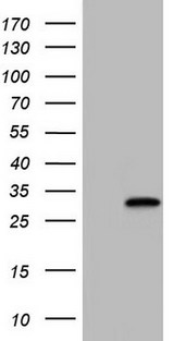 NKX3-1 Antibody - HEK293T cells were transfected with the pCMV6-ENTRY control. (Left lane) or pCMV6-ENTRY NKX3-1. (Right lane) cDNA for 48 hrs and lysed. Equivalent amounts of cell lysates. (5 ug per lane) were separated by SDS-PAGE and immunoblotted with anti-NKX3-1.