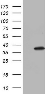 NKX3-1 Antibody - HEK293T cells were transfected with the pCMV6-ENTRY control (Left lane) or pCMV6-ENTRY NKX3-1 (Right lane) cDNA for 48 hrs and lysed. Equivalent amounts of cell lysates (5 ug per lane) were separated by SDS-PAGE and immunoblotted with anti-NKX3-1.