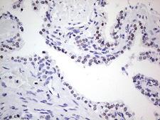 NKX3-1 Antibody - Immunohistochemical staining of paraffin-embedded Human prostate tissue within the normal limits using anti-NKX3-1 mouse monoclonal antibody. (Heat-induced epitope retrieval by 1 mM EDTA in 10mM Tris, pH8.5, 120C for 3min,