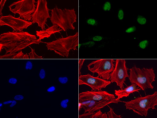 NKX3-1 Antibody - Immunofluorescent staining of HeLa cells using anti-NKX3-1 mouse monoclonal antibody  green, 1:100). Actin filaments were labeled with Alexa Fluor® 594 Phalloidin. (red), and nuclear with DAPI. (blue).