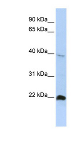 NKX3-2 / BAPX1 Antibody - NKX3-2 / BAPX1 antibody Western blot of HepG2 cell lysate. This image was taken for the unconjugated form of this product. Other forms have not been tested.