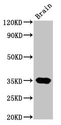 NKX3-2 / BAPX1 Antibody - Positive Western Blot detected in Rat brain tissue. All lanes: NKX3-2 antibody at 4.5 µg/ml Secondary Goat polyclonal to rabbit IgG at 1/50000 dilution. Predicted band size: 35 KDa. Observed band size: 35 KDa