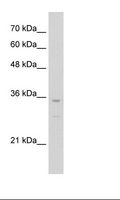 NKX3-2 / BAPX1 Antibody - Jurkat Cell Lysate.  This image was taken for the unconjugated form of this product. Other forms have not been tested.