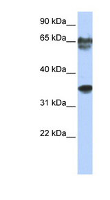 NKX3-2 / BAPX1 Antibody - NKX3-2 / BAPX1 antibody Western blot of Jurkat lysate. This image was taken for the unconjugated form of this product. Other forms have not been tested.