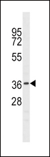 NKX6-1 Antibody - NKX6-1 Antibody western blot of mouse liver tissue lysates (35 ug/lane). The NKX6-1 antibody detected the NKX6-1 protein (arrow).