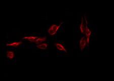 NKX6-1 Antibody - Staining COLO cells by IF/ICC. The samples were fixed with PFA and permeabilized in 0.1% Triton X-100, then blocked in 10% serum for 45 min at 25°C. The primary antibody was diluted at 1:200 and incubated with the sample for 1 hour at 37°C. An Alexa Fluor 594 conjugated goat anti-rabbit IgG (H+L) Ab, diluted at 1/600, was used as the secondary antibody.