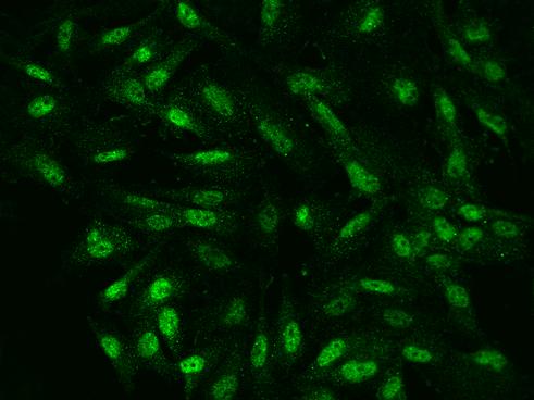 NKX6-1 Antibody - Immunofluorescence staining of NKX6-1 in U251MG cells. Cells were fixed with 4% PFA, permeabilzed with 0.1% Triton X-100 in PBS, blocked with 10% serum, and incubated with rabbit anti-Human NKX6-1 polyclonal antibody (dilution ratio 1:200) at 4°C overnight. Then cells were stained with the Alexa Fluor 488-conjugated Goat Anti-rabbit IgG secondary antibody (green). Positive staining was localized to Nucleus.