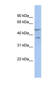 NKX6-1 Antibody - NKX6-1 antibody Western blot of Fetal Small Intestine lysate. This image was taken for the unconjugated form of this product. Other forms have not been tested.
