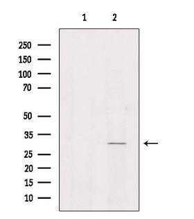 NKX6-2 Antibody - Western blot analysis of extracts of HeLa cells using NKX62 antibody. Lane 1 was treated with the blocking peptide.