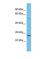 NKX6-2 Antibody - Western blot of Human Esophagus Tumor. NKX6-2 antibody dilution 1.0 ug/ml.  This image was taken for the unconjugated form of this product. Other forms have not been tested.