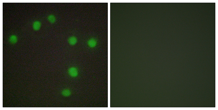 NKX6-3 Antibody - Immunofluorescence analysis of HUVEC cells, using NKX6.3 Antibody. The picture on the right is blocked with the synthesized peptide.