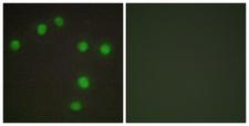 NKX6-3 Antibody - Immunofluorescence analysis of HUVEC cells, using NKX6.3 Antibody. The picture on the right is blocked with the synthesized peptide.