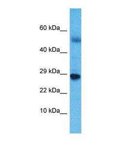 NKX6-3 Antibody - Western blot of Human Esophagus Tumor. NKX6-3 antibody dilution 1.0 ug/ml.  This image was taken for the unconjugated form of this product. Other forms have not been tested.