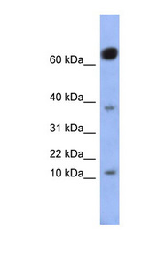 NKX6-3 Antibody - NKX6-3 antibody Western blot of Fetal Small Intestine lysate. This image was taken for the unconjugated form of this product. Other forms have not been tested.