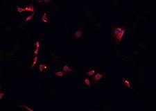 NKX6-3 Antibody - Staining K562 cells by IF/ICC. The samples were fixed with PFA and permeabilized in 0.1% Triton X-100, then blocked in 10% serum for 45 min at 25°C. The primary antibody was diluted at 1:200 and incubated with the sample for 1 hour at 37°C. An Alexa Fluor 594 conjugated goat anti-rabbit IgG (H+L) Ab, diluted at 1/600, was used as the secondary antibody.